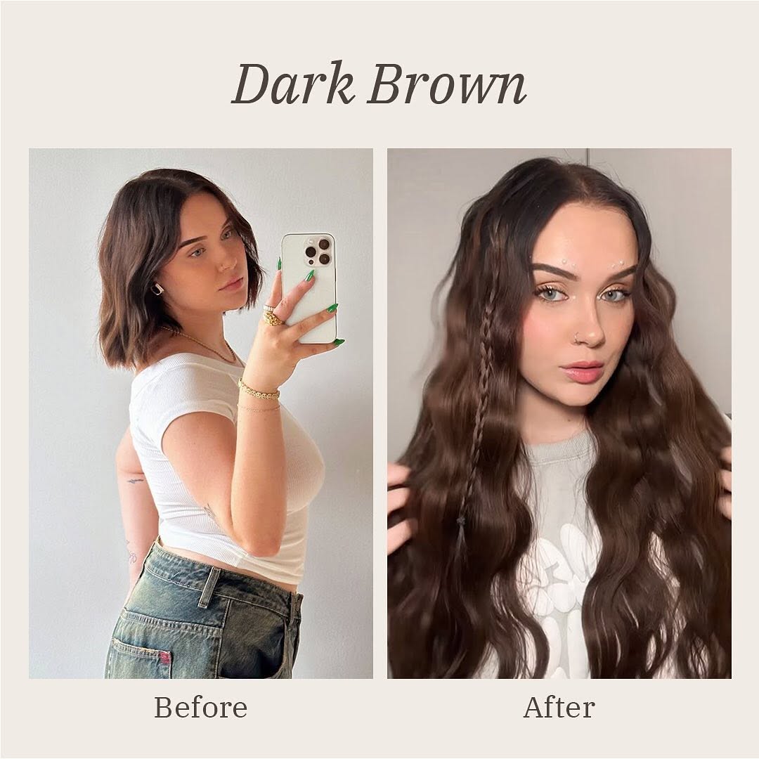 头发稀疏改善前